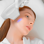 BBL SkinTyte - термолифтинг кожи лица